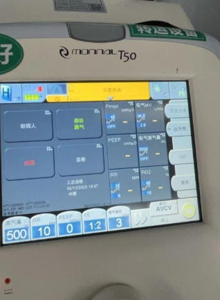 法國天馬呼吸機主板電池加校準monnal t50